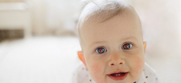 Lo screening oculare nei neonati: il riflesso rosso