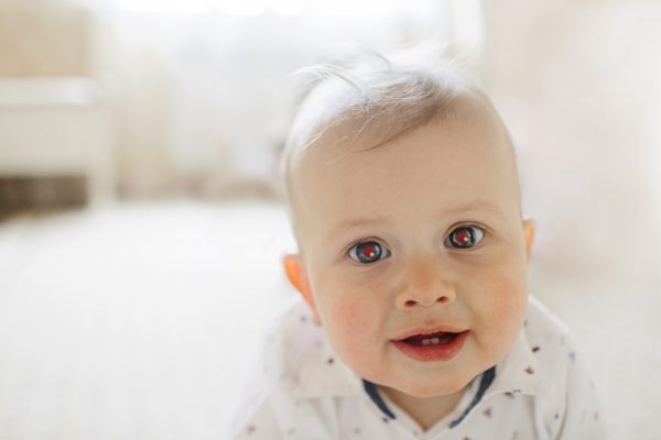 Lo screening oculare nei neonati: il riflesso rosso