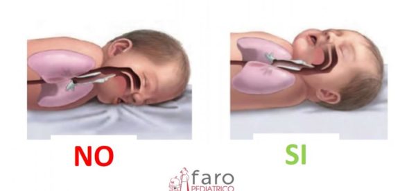 Rigurgito notturno: in che posizione mettere il neonato durante il sonno?