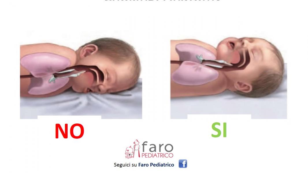 Al momento stai visualizzando Rigurgito notturno: in che posizione mettere il neonato durante il sonno?