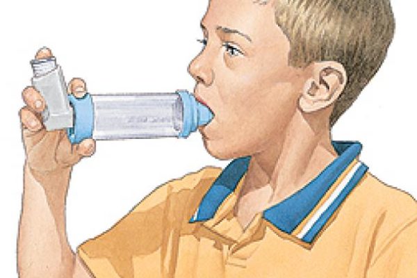 Asma e bronchite asmatica in bambini: cause, sintomi, allergia, terapia