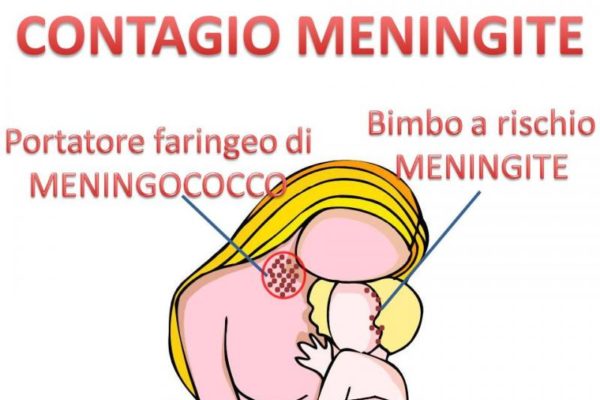 Meningite, contagio e vaccino anti-meningococco
