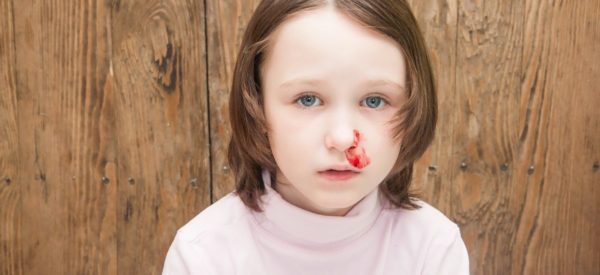 Epistassi o sangue dal naso nei bambini: cause e rimedi | Faro Pediatrico
