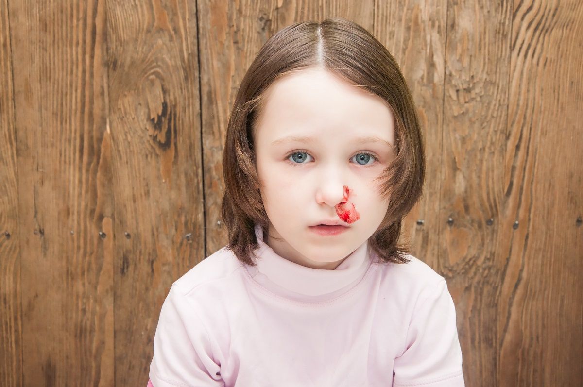 Al momento stai visualizzando Epistassi o sangue dal naso nei bambini: cause e rimedi | Faro Pediatrico